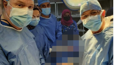 فريق طبي ينجح في استئصال ورم من صدر طفلة بمستشفى بنها الجامعي