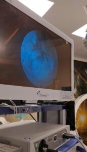 إجراء أول عملية جراحية باستخدام المنظار الجراحي للعمود الفقري بمستشفى جامعة بنها