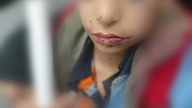 طفل يفقد عينيه بطلق خرطوش أثناء عودته من المدرسة .. ووالده: عايز حق ابني