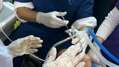 استخراج ورم من الحنجرة .. فريق جراحي يتمكن من إنقاذ طفل بمستشفى بنها الجامعي