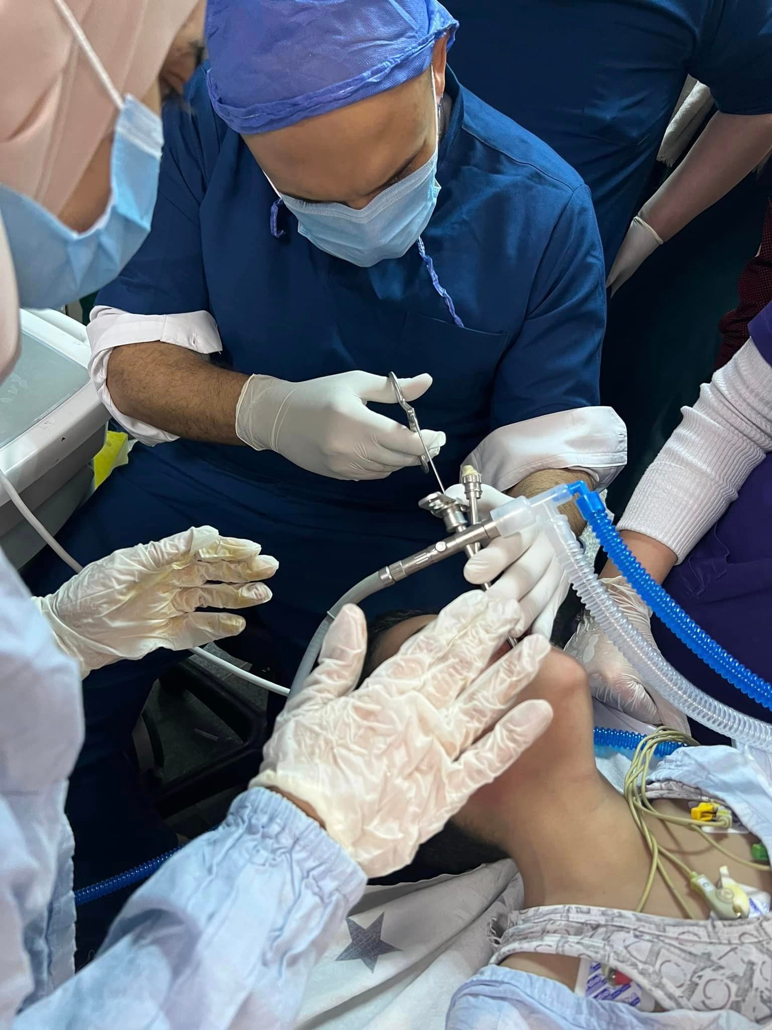 استخراج ورم من الحنجرة .. فريق جراحي يتمكن من إنقاذ طفل بمستشفى بنها الجامعي