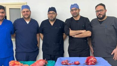 استئصال ورم خبيث يزن 10 كيلو جرام لمريضة بمستشفى الخانكة