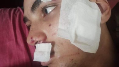 والد طالب ثانوي يتهم 3 أشخاص بإصابة نجله بـ 25 غرزة أثناء سرقته بشبرا الخيمة والد طالب ثانوي يتهم 3 أشخاص بإصابة نجله بـ 25 غرزة أثناء سرقته بشبرا الخيمة