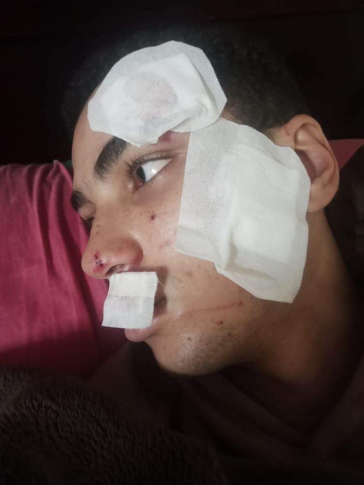 والد طالب ثانوي يتهم 3 أشخاص بإصابة نجله بـ 25 غرزة أثناء سرقته بشبرا الخيمة