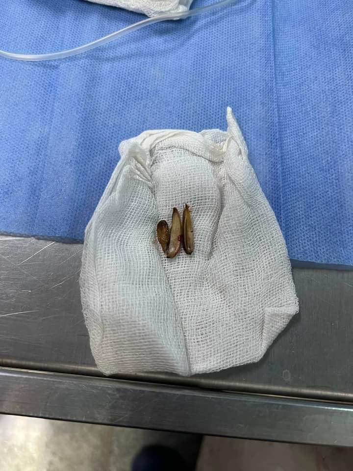 أخرها رضيع اللب .. بنها الجامعي في مهمة إنقاذ والجزار يحذر الأهالي