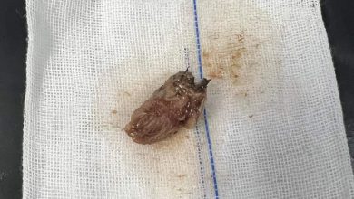 حبة فراولة قاتلةسدت مجري الهواء .. مصرع طفل بسبب فراولة ببنها الجامعي حبة فراولة قاتلةسدت مجري الهواء .. مصرع طفل بسبب فراولة ببنها الجامعي