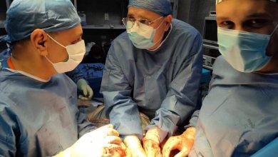 أكبر عمليات جراحة الصدر.. إجراء جراحة نادرة لشاب بمستشفى بنها الجامعي