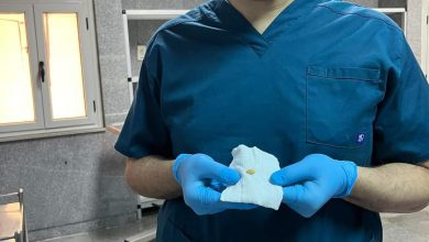 تعرضا لانسداد مجرى التنفس .. إنقاذ حياة طفلين بمستشفى بنها الجامعي