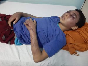 تسبب له بارتجاج في المخ.. مأساة الطفل محمد ضحية تعذيب والده