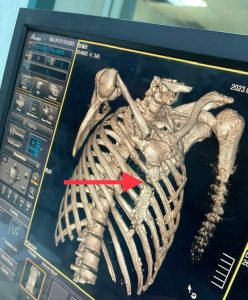 إنقاذ حياة شخصين تعرضا لحادث ببنها الجامعي