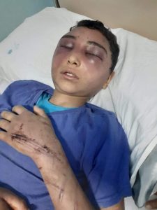 تسبب له بارتجاج في المخ.. مأساة الطفل محمد ضحية تعذيب والده