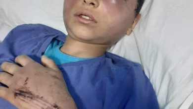 تسبب له بارتجاج في المخ.. مأساة الطفل محمد ضحية تعذيب والده