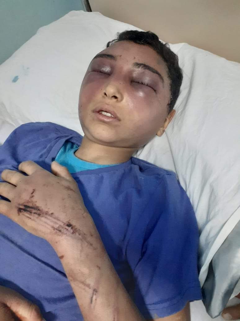 تسبب له بارتجاج في المخ.. مأساة الطفل محمد ضحية تعذيب والده