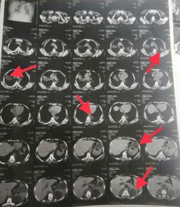 إنقاذ حياة شخصين تعرضا لحادث ببنها الجامعي