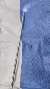 فريق طبي بأطفال بنها التخصصي ينقذ حياة طفلة ابتلعت دبوس