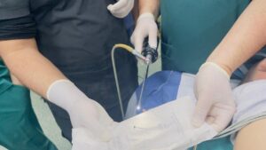 فريق طبي بأطفال بنها التخصصي ينقذ حياة طفلة ابتلعت دبوس