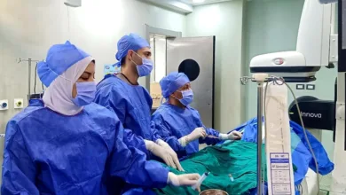 تشغيل عمليات القسطرة المخية بمستشفى بنها للتأمين الصحي