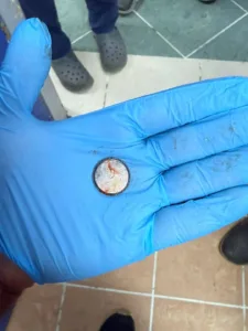 استخراج بطارية من مريء طفل بمستشفى أطفال بنها - صور