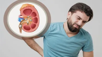مشروبات تحمي الكلى وأخرى تضرها: دليل للوقاية من حصوات الكلى