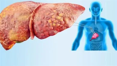 تجنب تلك المأكولات .. أطعمة تسبب مشاكل صحية للكبد
