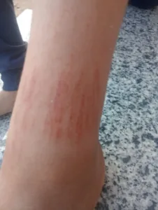 ولية أمر تشكو اعتداء معلمة على نجلها داخل مدرسة ابتدائية بطوخ والتعليم تتابع الواقعة