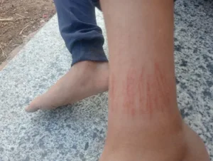 ولية أمر تشكو اعتداء معلمة على نجلها داخل مدرسة ابتدائية بطوخ والتعليم تتابع الواقعة