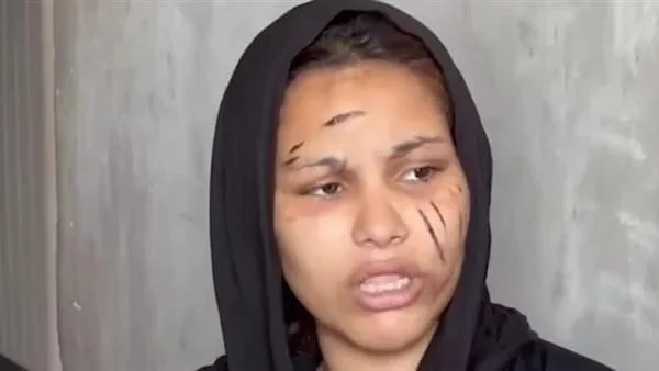 ضبط زوج بعد واقعة اعتداء بسلاح أبيض على زوجته بشبرا الخيمة وإصابات بالغة بالمجني عليها ضبط زوج بعد واقعة اعتداء بسلاح أبيض على زوجته بشبرا الخيمة وإصابات بالغة بالمجني عليها